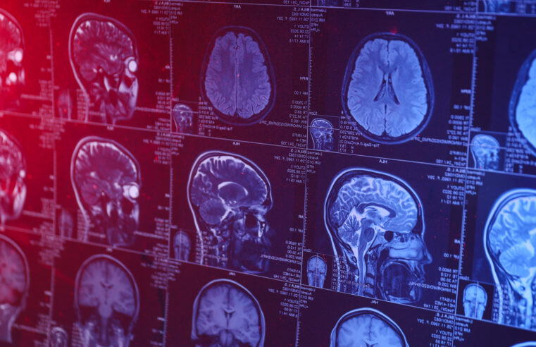 Neurocientista explica o que acontece no cérebro enquanto morremos