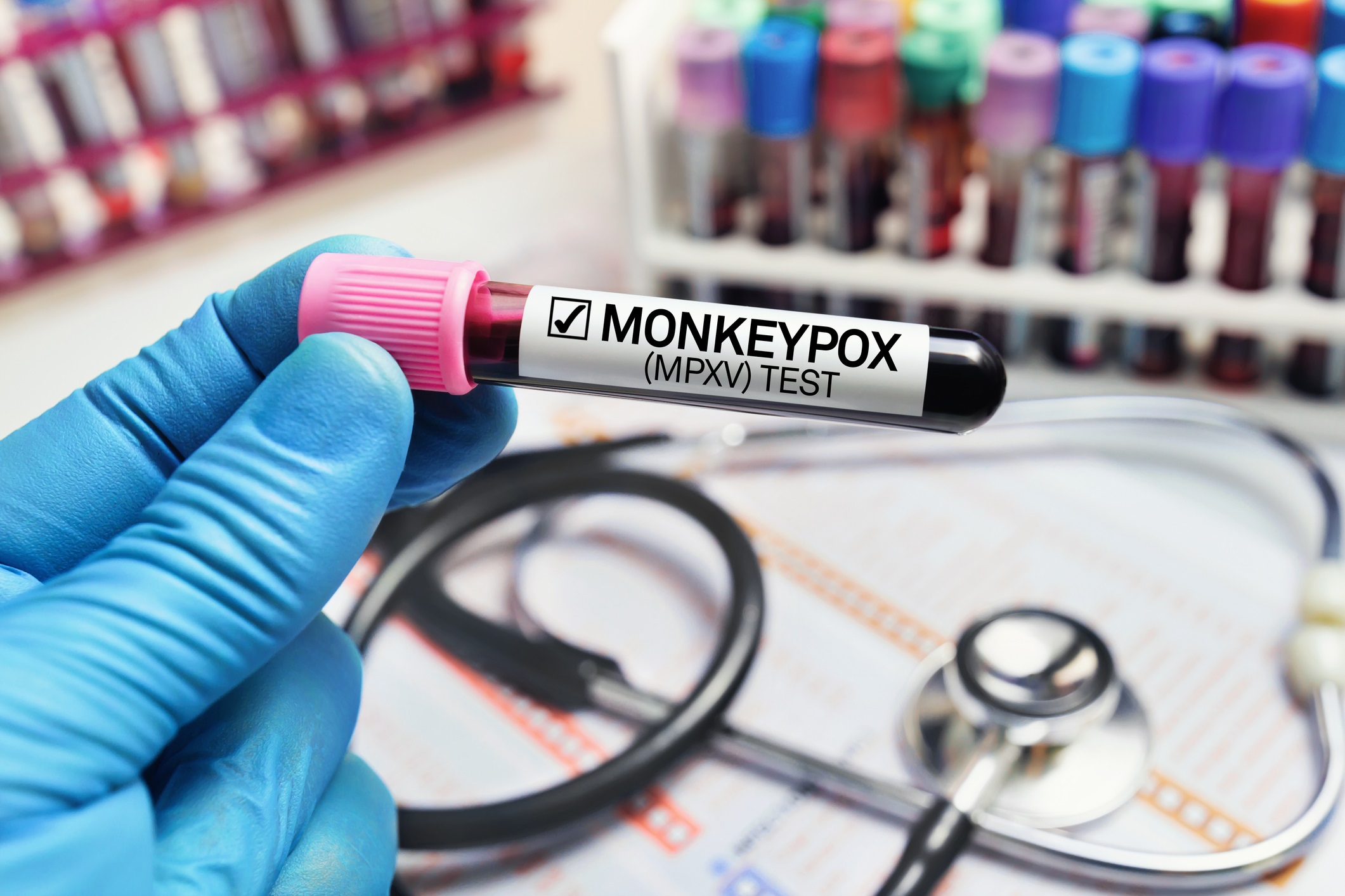 OMS volta a declarar mpox como ’emergência de saúde global’: Brasil corre risco?