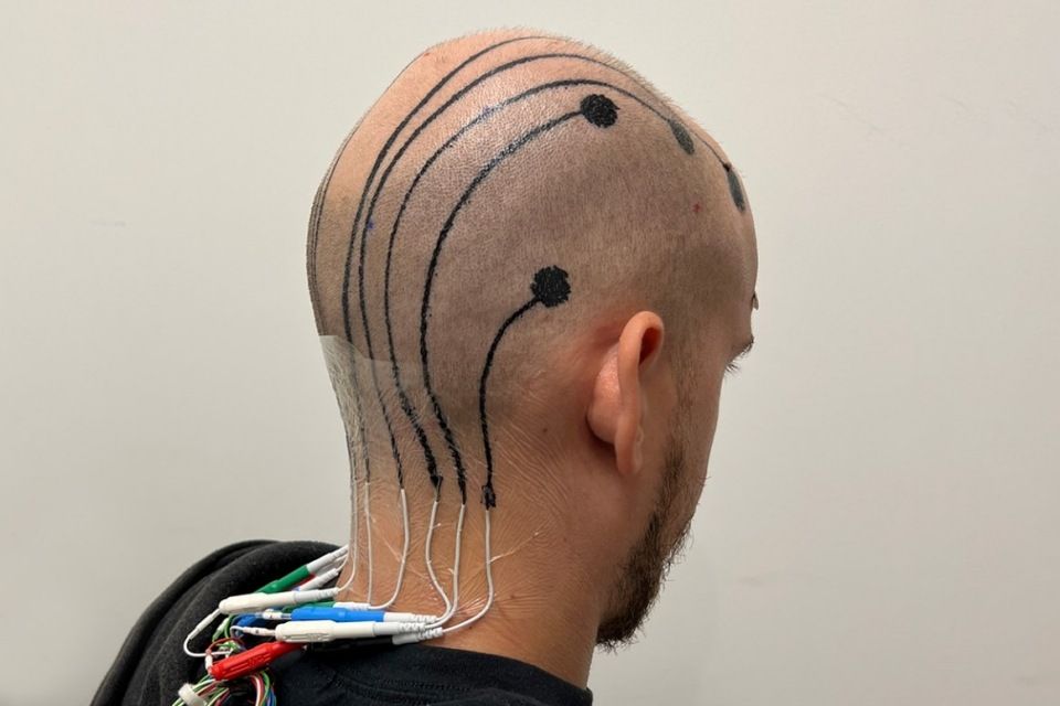 Cyberpunk 2077? Conheça as ‘tatuagens eletrônicas’ desenvolvidas por cientistas para diagnosticar doenças