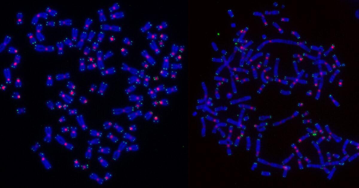 Por que algumas células cancerosas resistem à radioterapia? Estudo explica