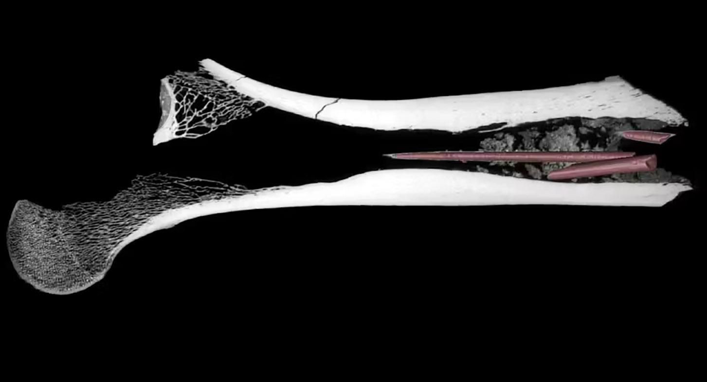 Veneno de flecha mais antigo do mundo é achado dentro de osso de 7 mil anos