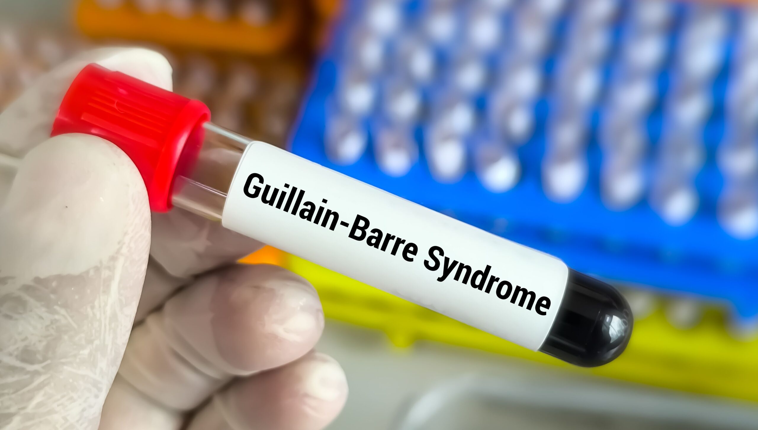 Surto: Índia registra mais de 160 casos e cinco mortes causadas pela Síndrome de Guillain-Barré